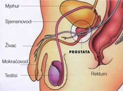 prostata